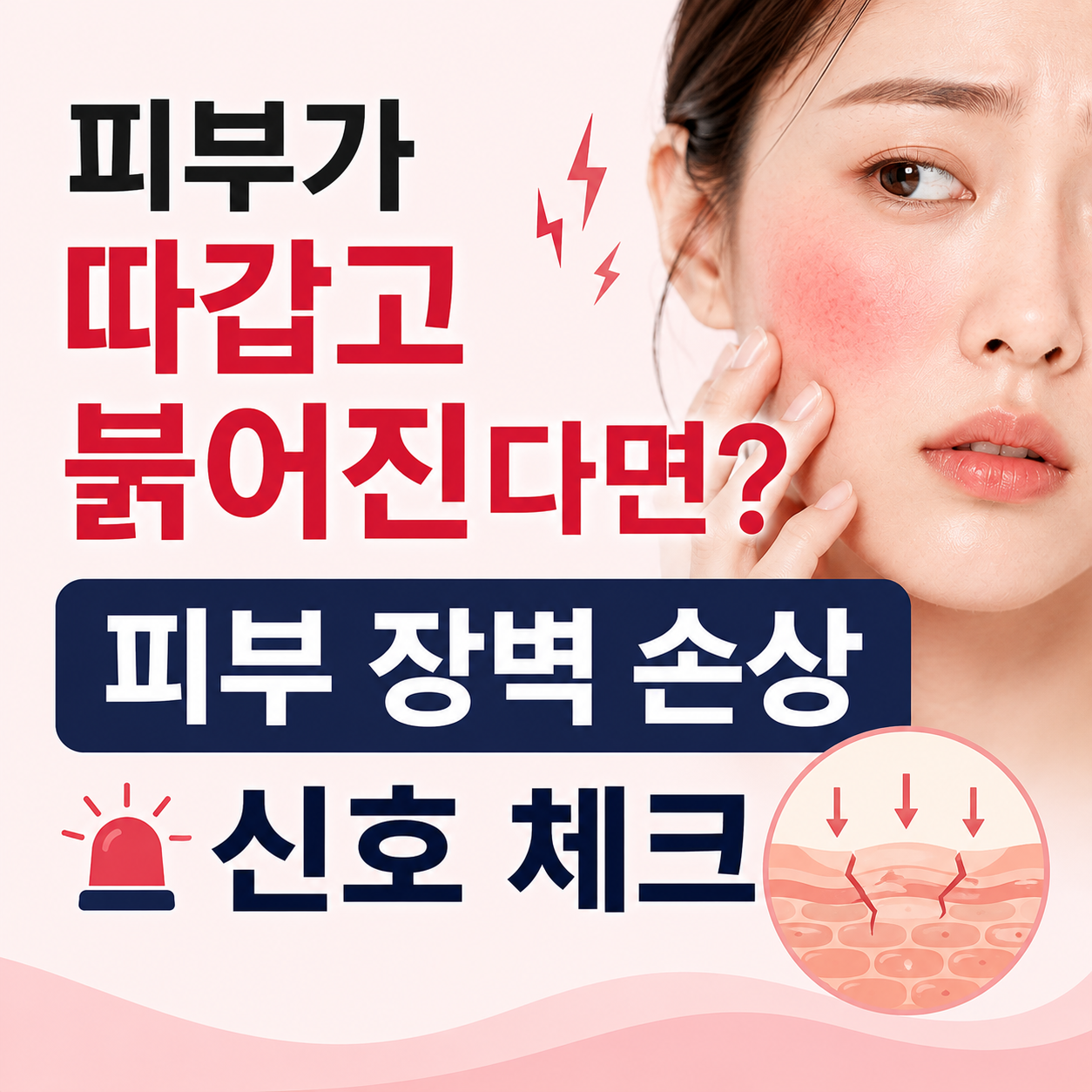 피부 장벽 손상 신호
