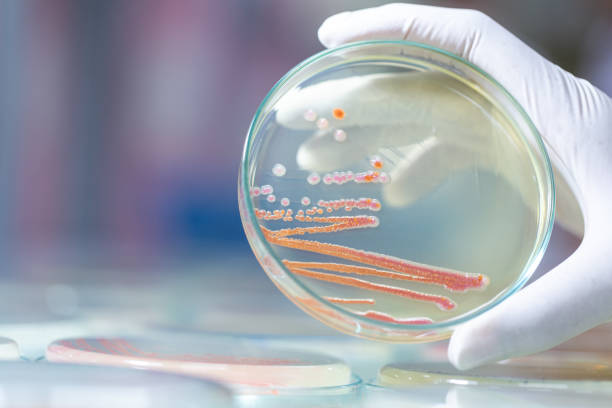 화장실 분홍색 분홍곰팡이 물 때 곰팡이 분홍 청소 얼룩 제거 세균 건강 면역력 호흡기 청소 욕실 변기 얼룩 박테리아 세라티아 마르세센스 락스 표백제