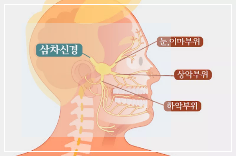 삼차 신경통