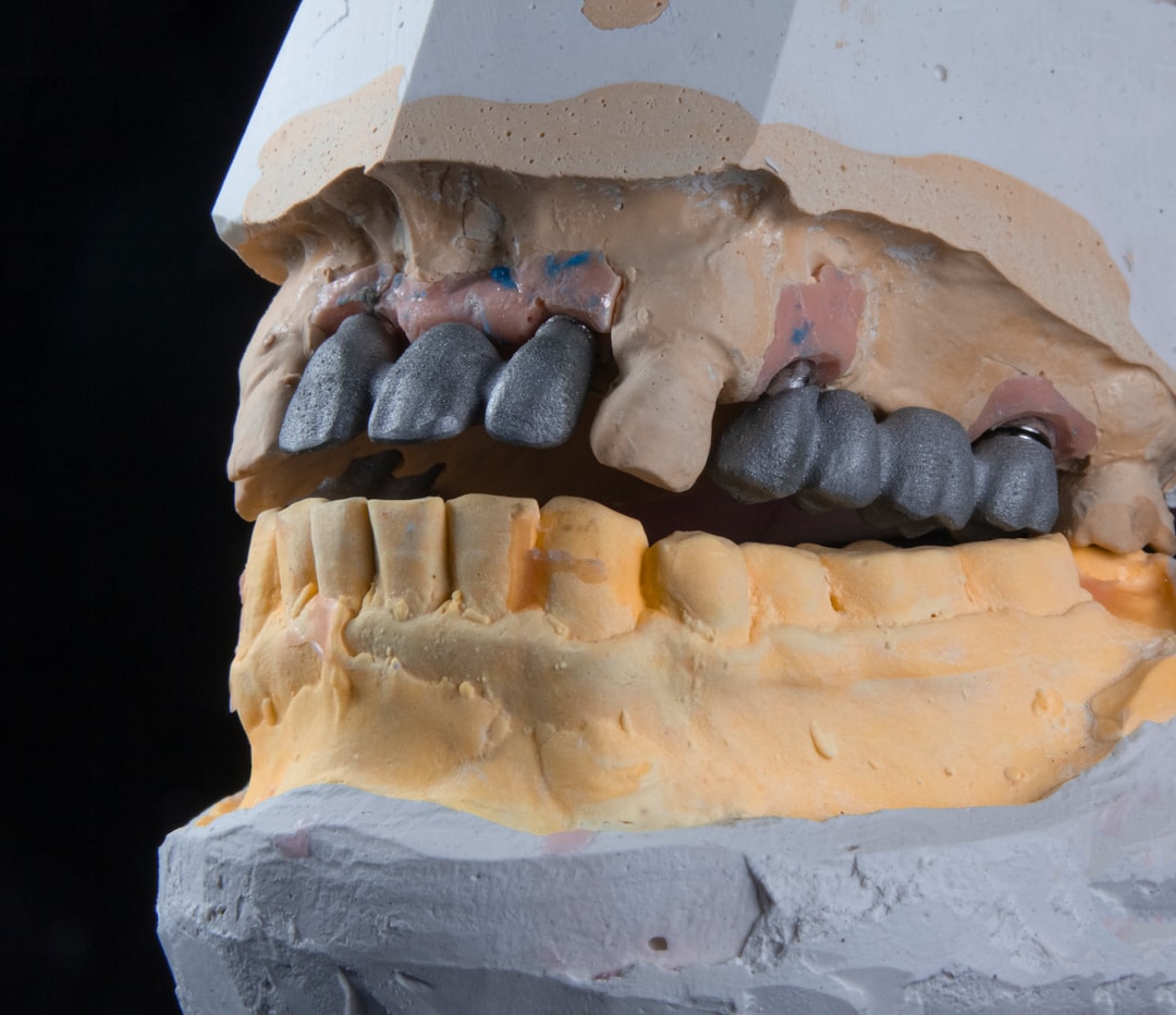 Denture
