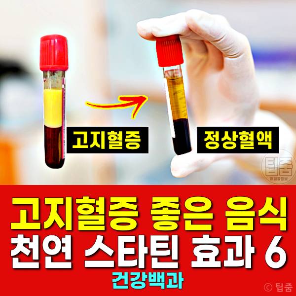 고지혈증 좋은 음식 고지혈증약 스타틴 효과