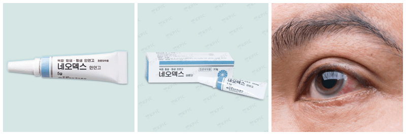 네오덱스 안연고, 결막염 사진