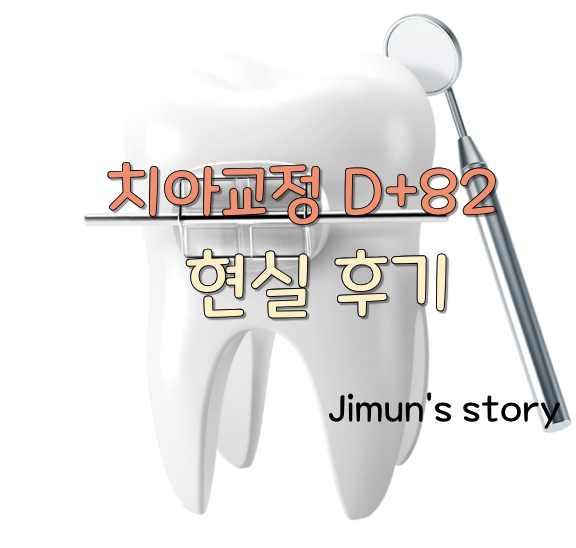 치아교정 D+82 썸네일 사진