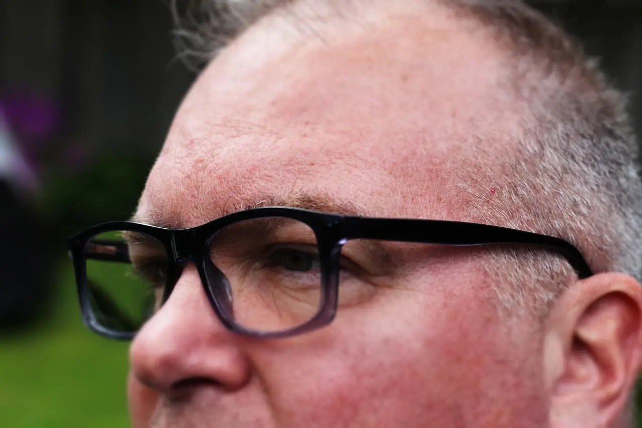 중장년 남성 탈모, 초기 대응법으로 진행 막는 방법