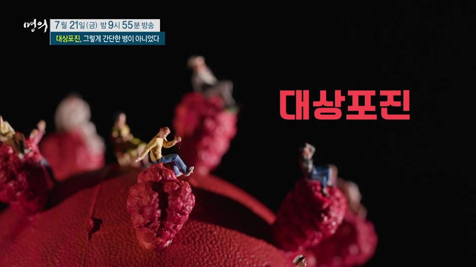 대상포진 후 신경통, 합병증, 이명, 시력 저하 치료 방법 마취통증의학과 전문의 최상식, 김재헌 교수 예약 추천