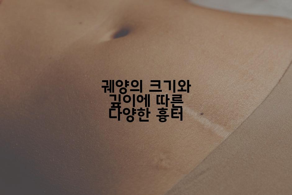 궤양의 크기와 깊이에 따른 다양한 흉터