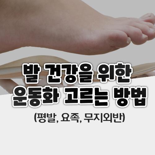 발 건강을 위한 운동화 고르는 방법 (평발, 요족, 무지외반)