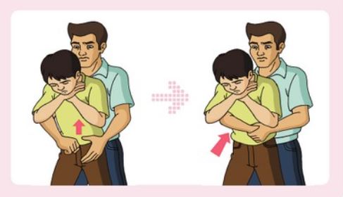 어린이 하임리히법