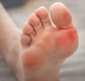 발바닥통증의 원인