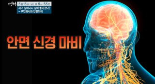 김진 교수 EBS 명의 구안와사 안면마비 후유증