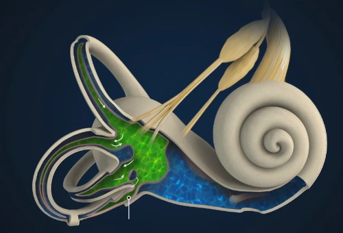 메니에르 병에 좋은 음식 습관