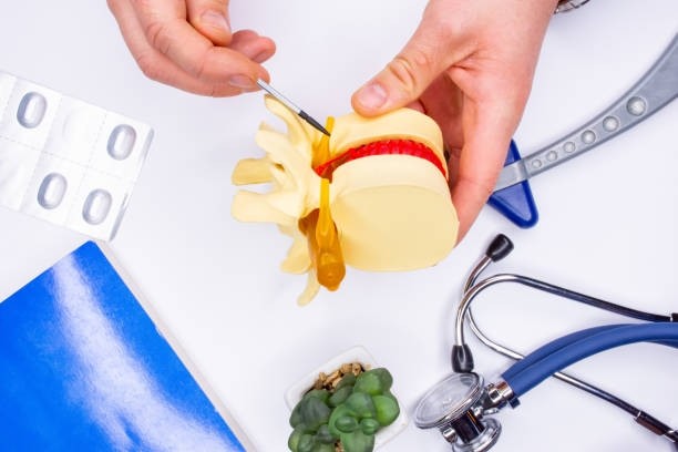 허리디스크 4번 5번 증상 다리저림 치료법