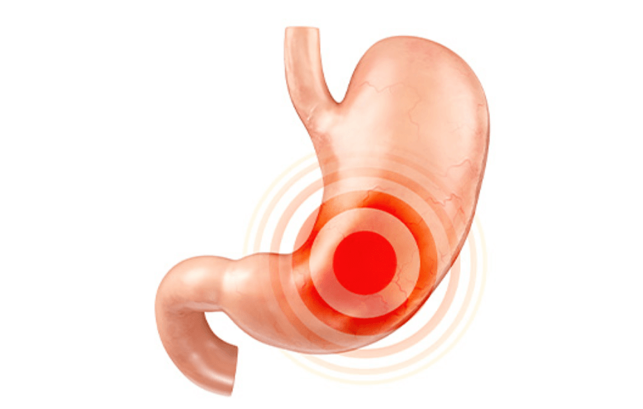 위-건강에-적신호가-켜진-모습