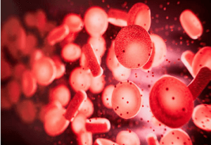 전신성 홍반성 낭창