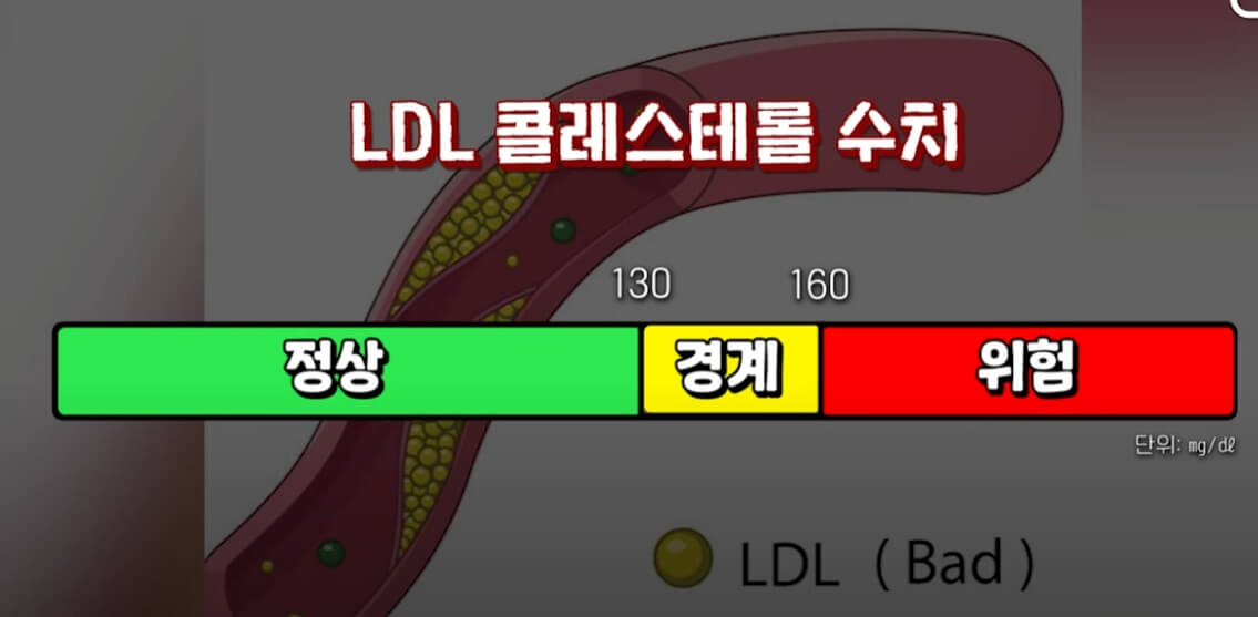 콜레스테롤 고지혈증