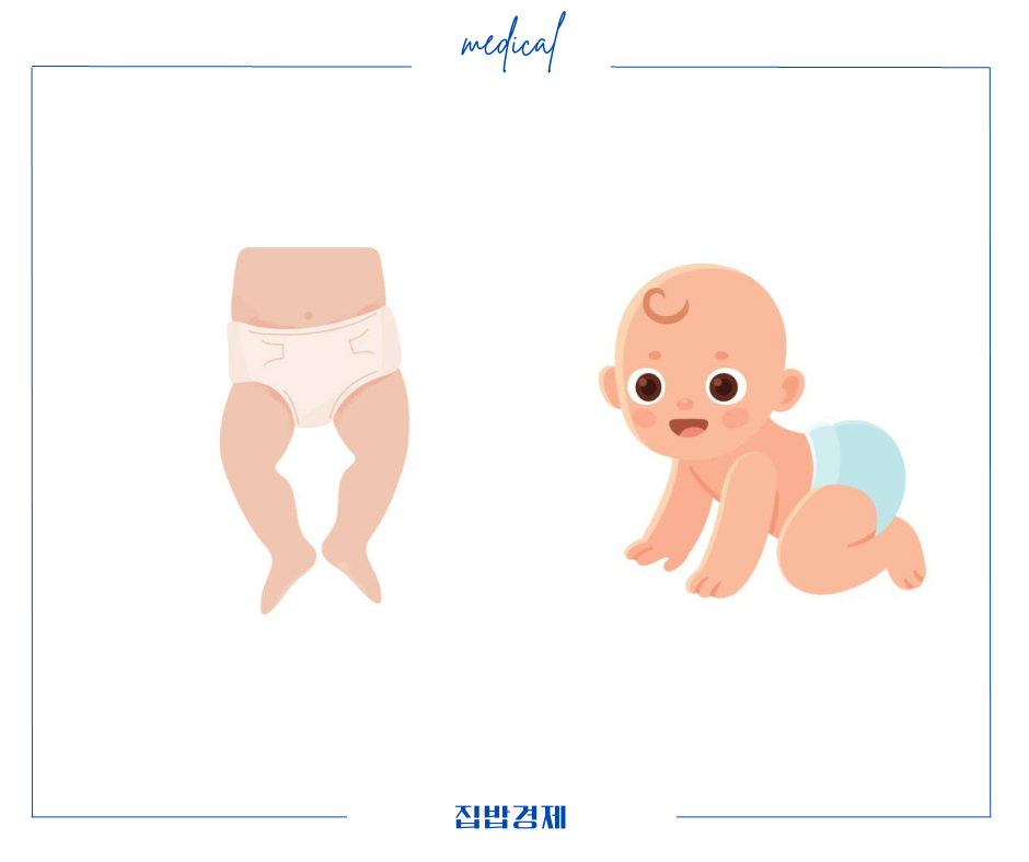 아기 땀띠 증상