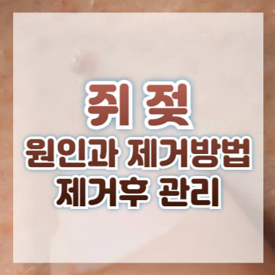 쥐젖
쥐젖 제거
쥐젖 원인
쥐젖 연고
쥐젖 패치
쥐젖 사과식초
피부 섬유종
쥐젖 치료
조합 키워드
쥐젖 생기는 이유
쥐젖 제거 방법
쥐젖 제거 비용
쥐젖 자연 제거
쥐젖 사과식초 효과
쥐젖 제거 연고 추천
쥐젖 냉동 치료
쥐젖 레이저 제거
쥐젖 패치 사용법
쥐젖 제거 후 관리법