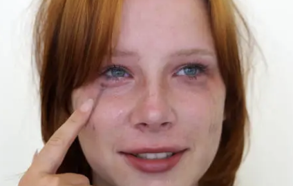 담낭염의 증상 18