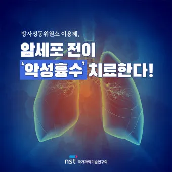 폐에 물이 차는 원인 증상 물참 관리 포인트에 대한 건강정보_25
