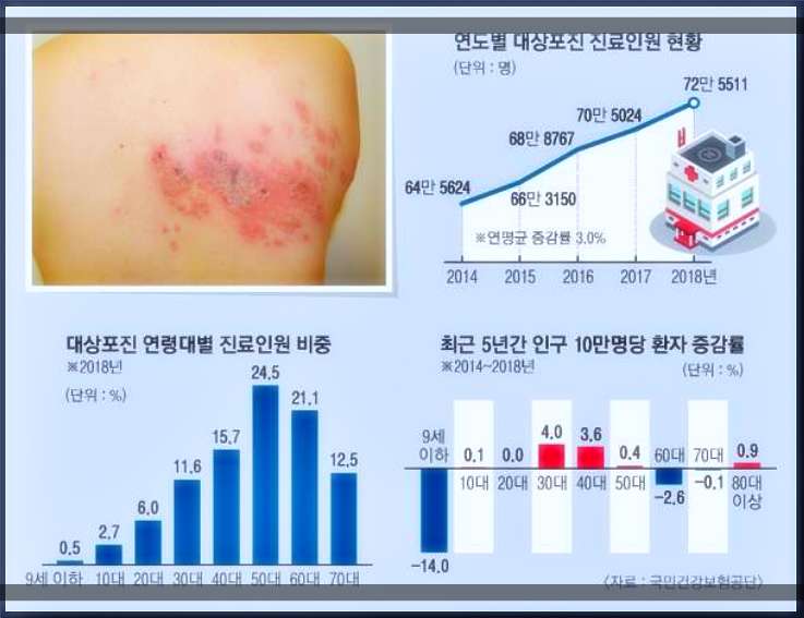 대상포진연령대