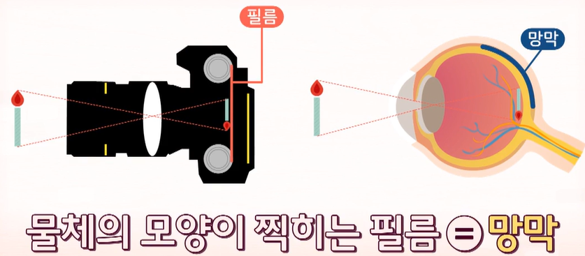황반