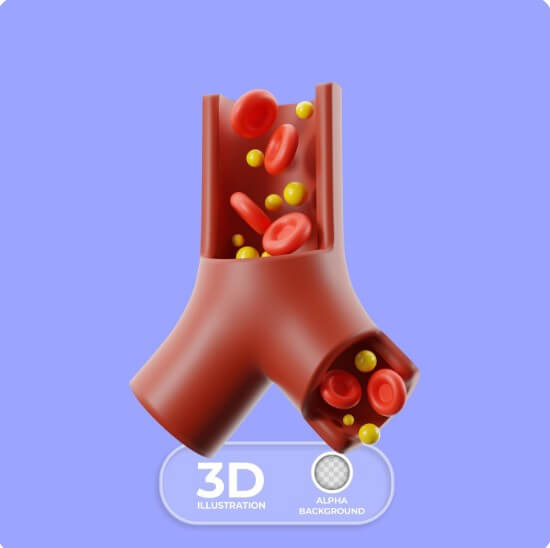 혈관 속 노폐물