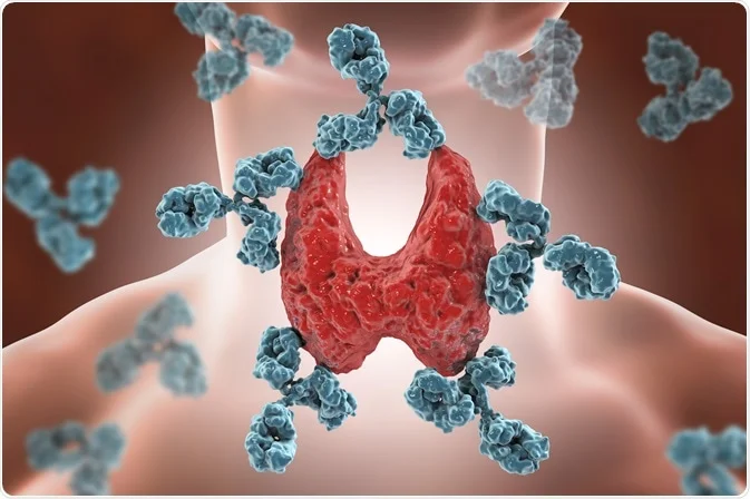 다양한 만성 질환군 자가면역질환