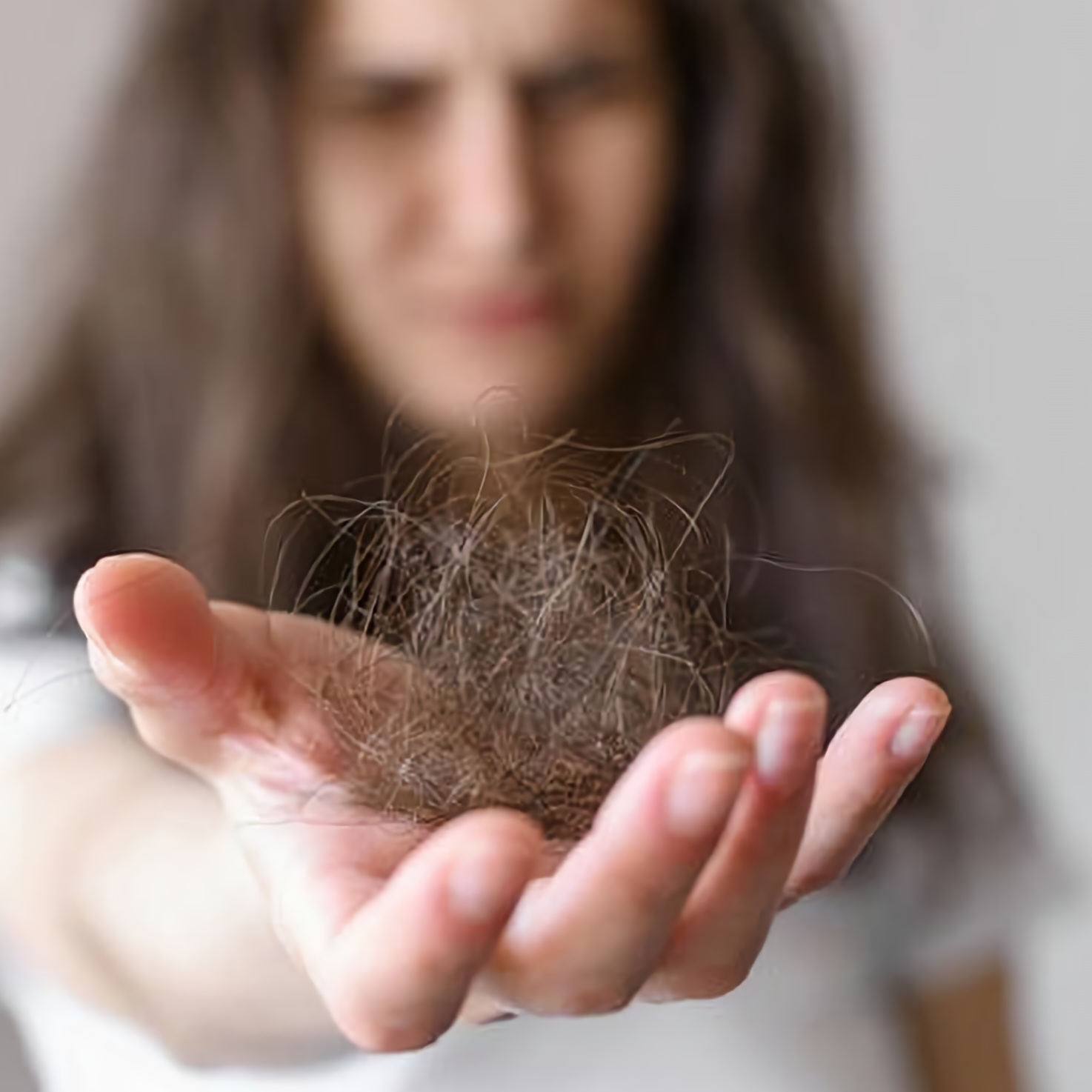 중장년 탈모(회복,약물과 자연요법,자연치유력)에 대해 설명하고 있습니다.