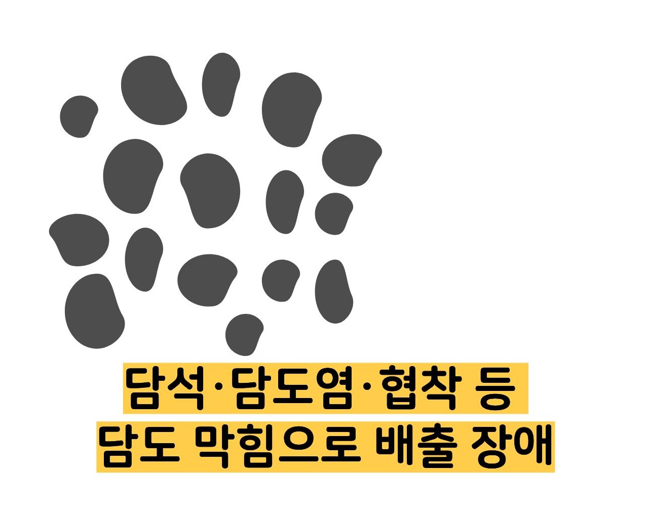 빌리루빈 수치상승 원인