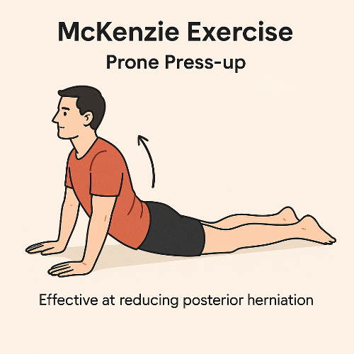 허리디스크에 좋은 운동ㅣ금지 운동ㅣ증상