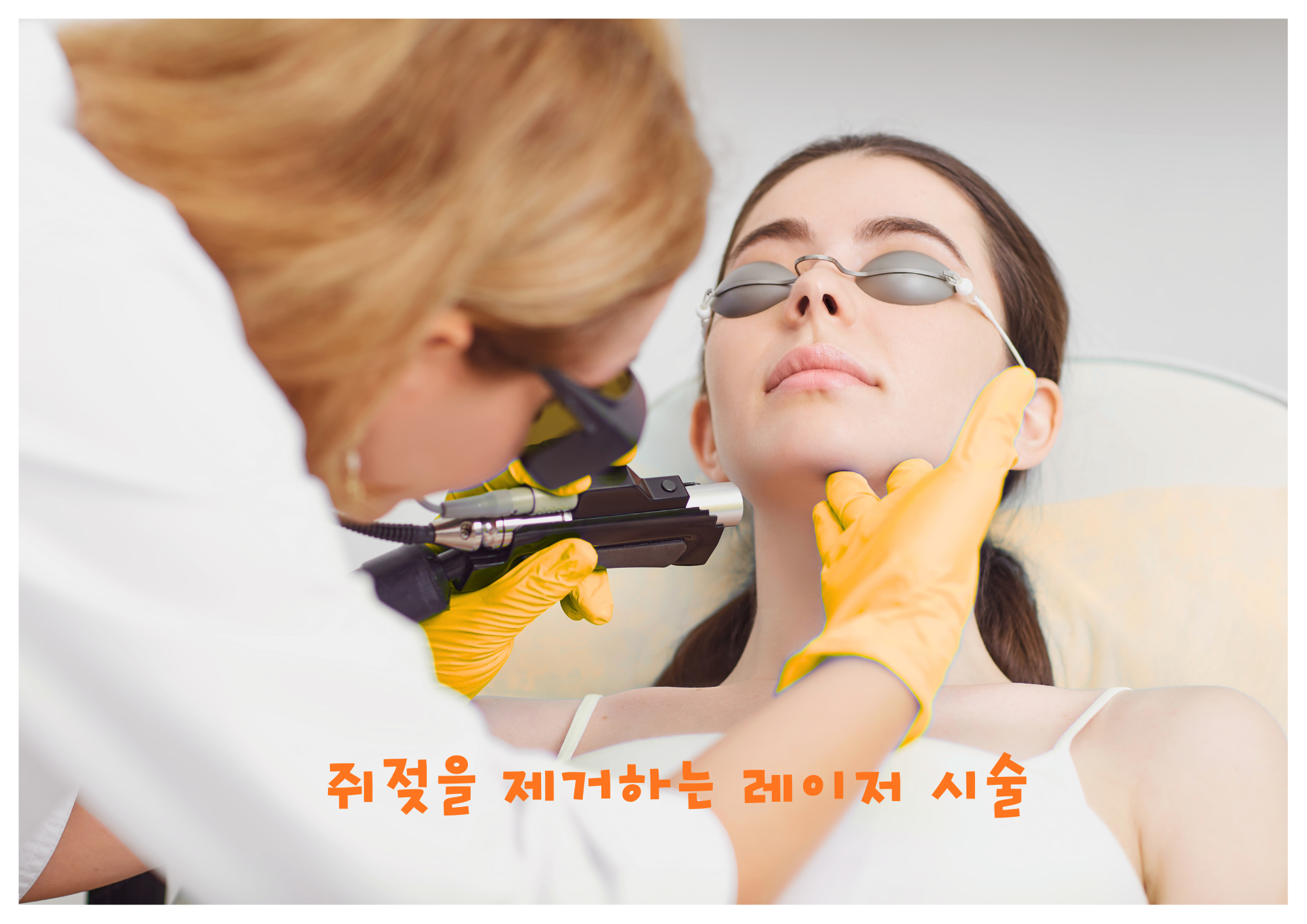 쥐젖을 제거하는 레이저 시술