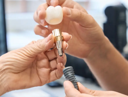 임플란트의 구조물이 손상으로 인한 임플란트 흔들림