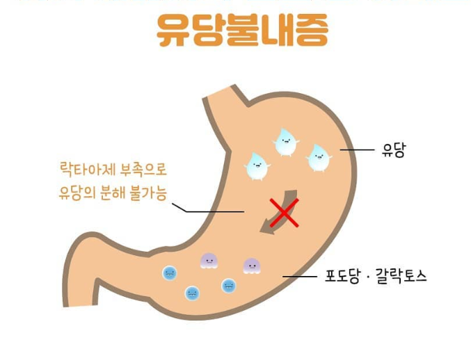 유당불내증
