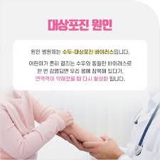 대상포진 초기증상