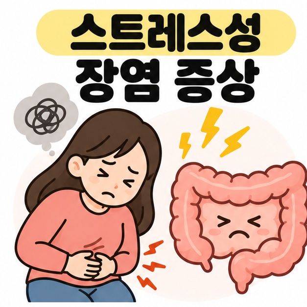 스트레스성 장염 증상 문구와 배를 감싸는 사람, 장과 스트레스 아이콘을 보여주는 대표 카드
