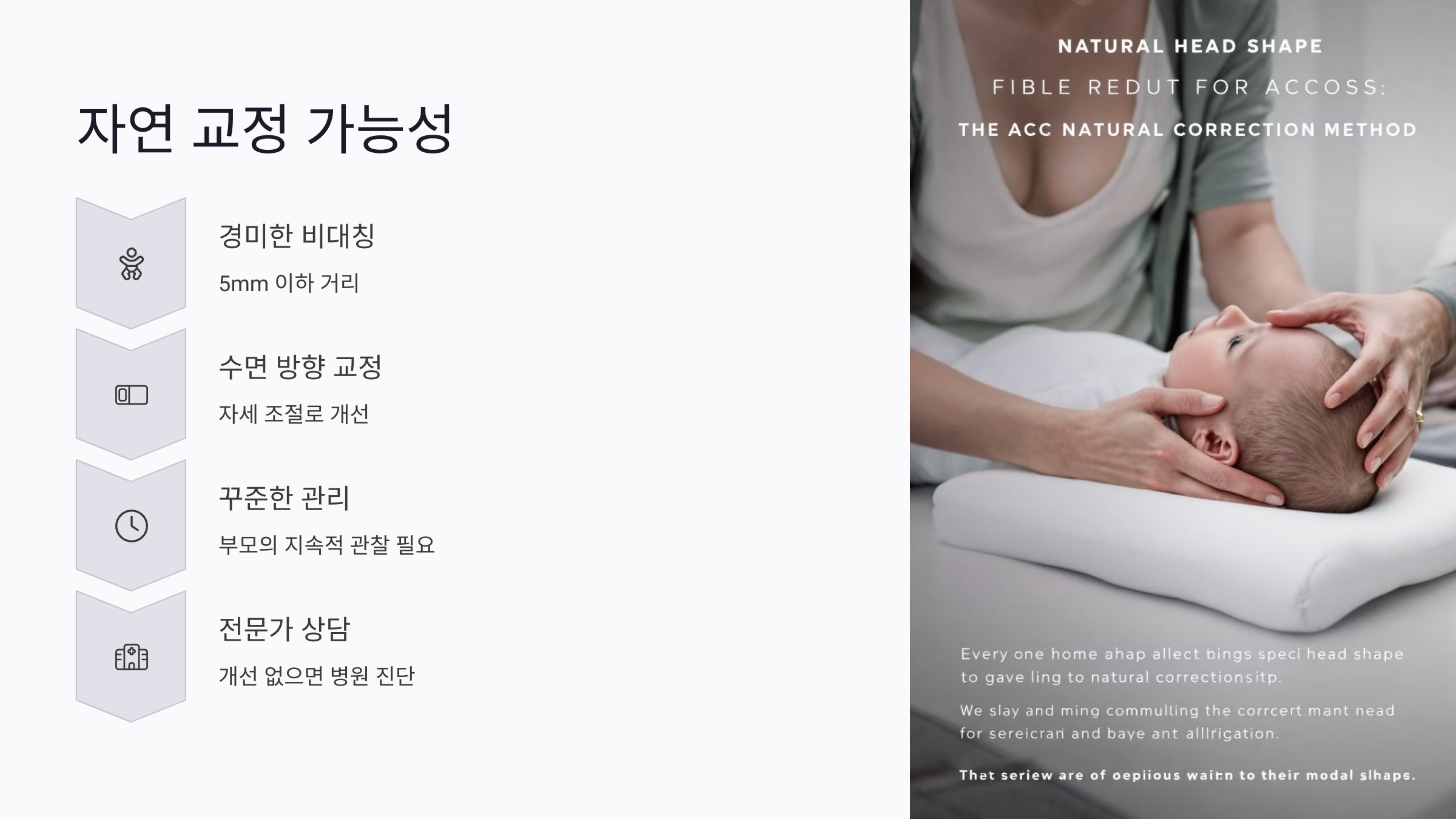 아기 두상 교정 헬멧 비용, 얼마나 드나?