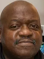 돼지 신장 이식 사망