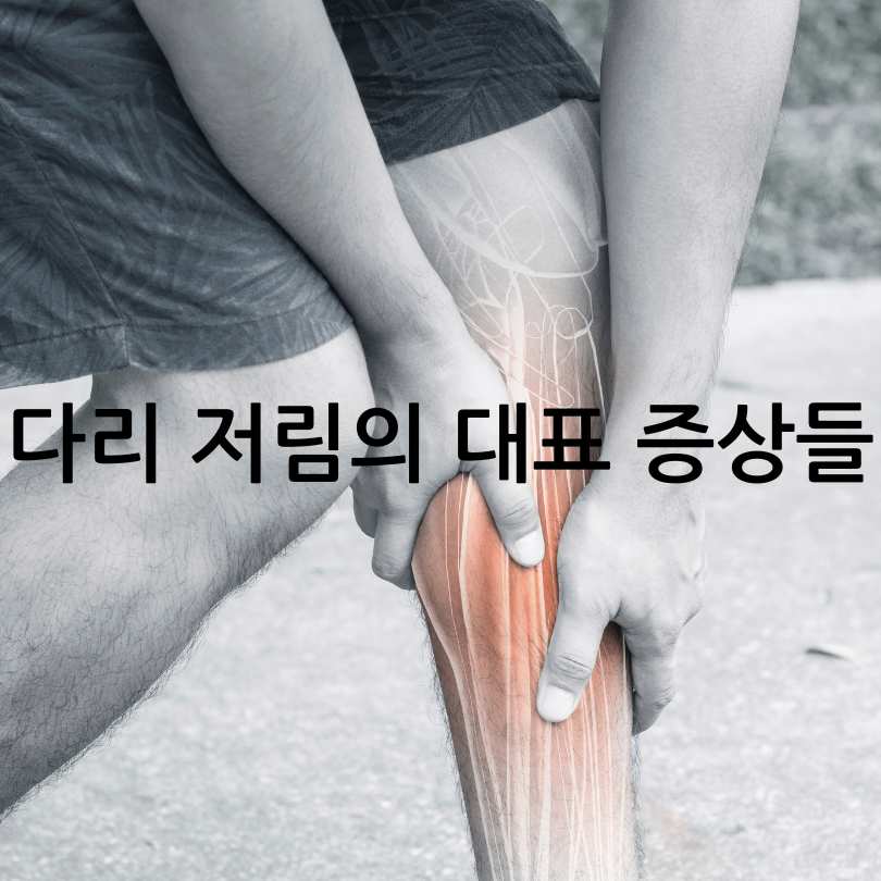 다리 저림 증상&amp;#44; 원인&amp;#44;치료법과 생활습관