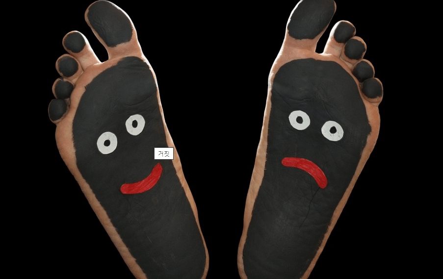 티눈 제거 방법을 활용 하여 발바닥에 티눈을 없애고 웃고 있는 그림을 발바닥에 그려 놓았다