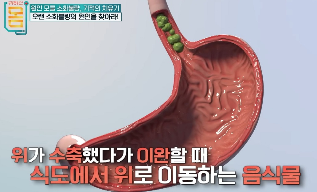 소화기내과-김도훈-교수