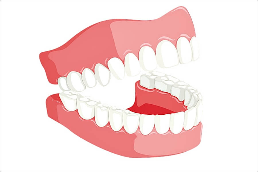 LGG 유산균 추천제품 및 효능