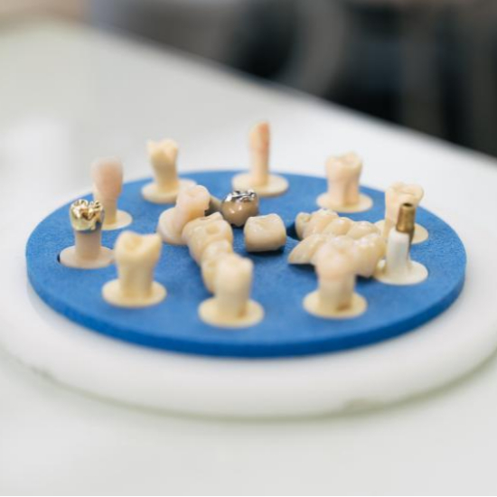 임플란트 시술과정 단계별 설명7