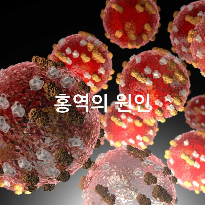 성인 홍역과 어린이 홍역의 차이점