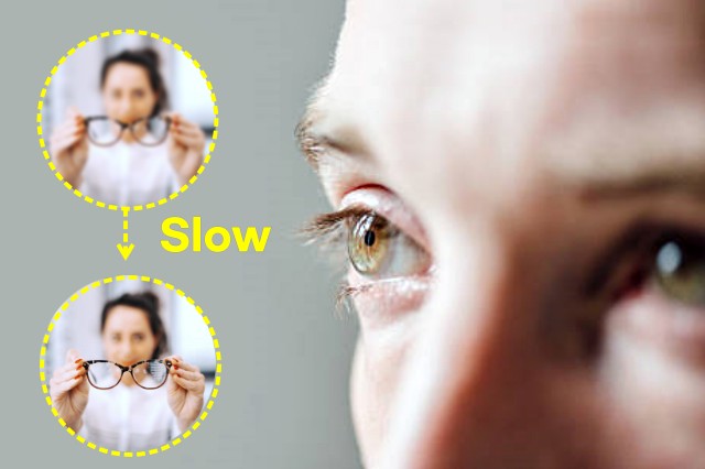 옆으로 누워서 스마트폰, 짝눈 시력 눈매 교정, 사시 부동시 원인