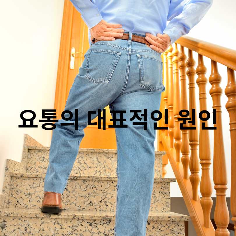 요통 원인과 요통 스트레칭 효과