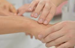 백반증 초기증상 32