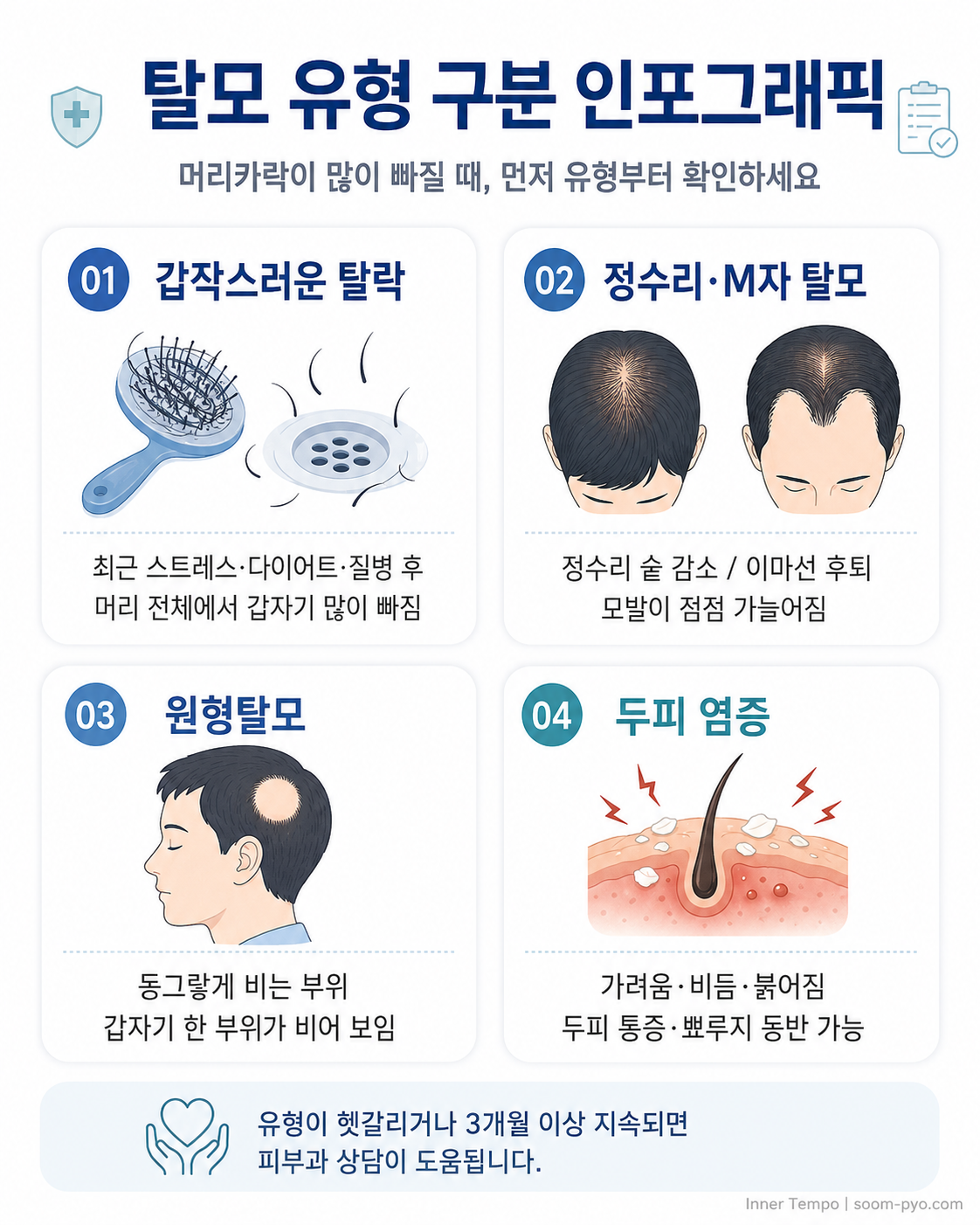 탈모 유형 구분