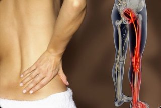 좌골신경통 증상