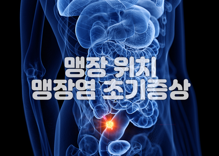 맹장 끝부분의 충수 돌기에 염증이 생겨있다