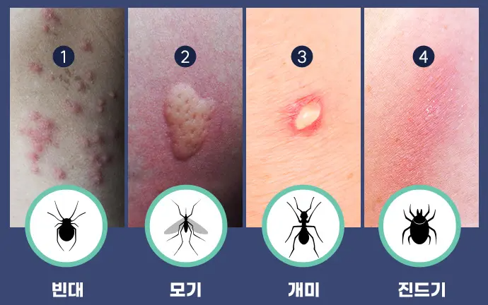 빈대물림구별법